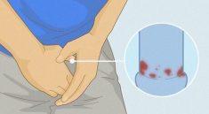 infeksi hpv
