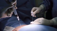 donor sumsum tulang