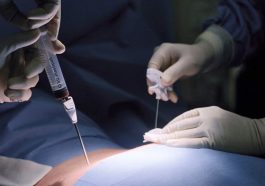 donor sumsum tulang