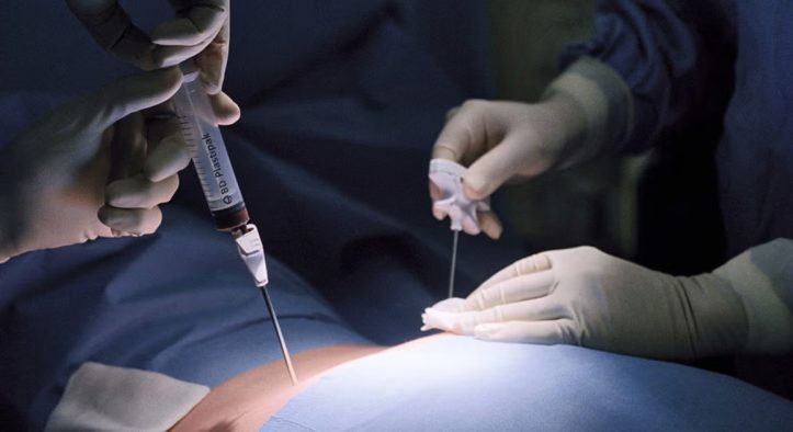 Donor Sumsum Tulang: Harapan Baru bagi Pasien Penyakit Serius