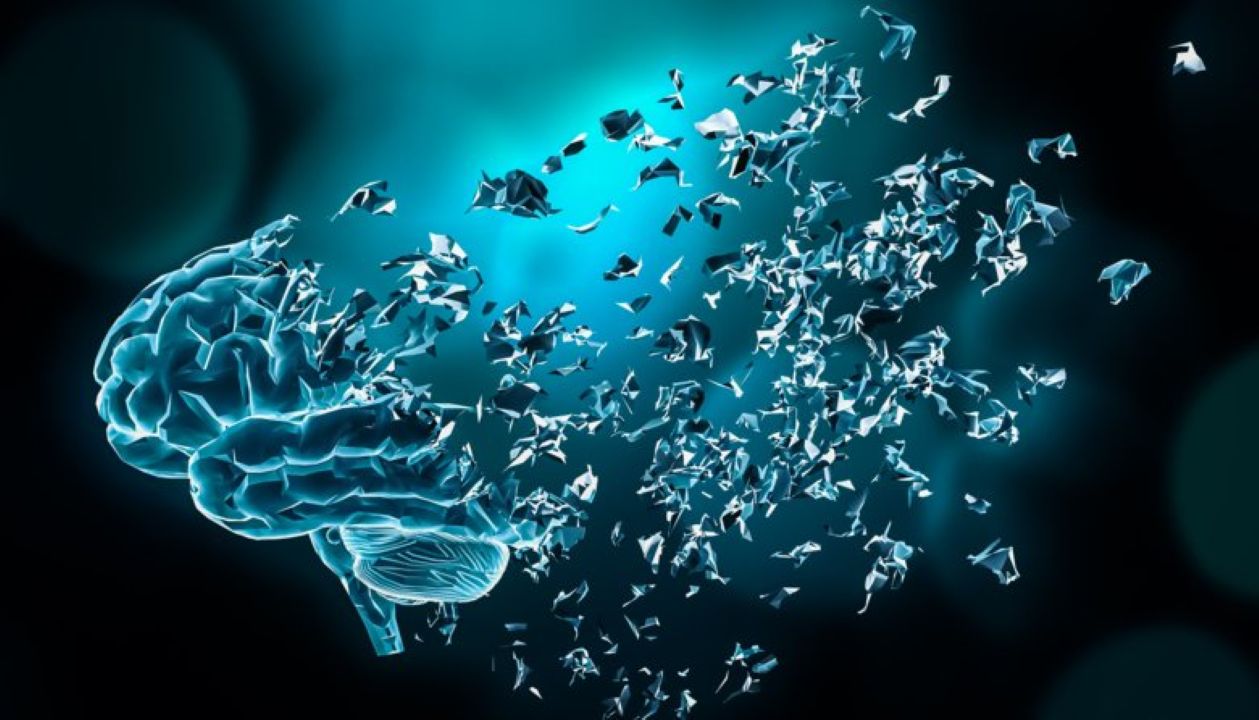 pasien alzheimer termuda