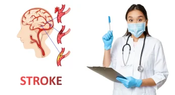 Benarkah Kurang Tidur Menyebabkan Stroke? Ini Kata Dokter