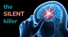 silent stroke