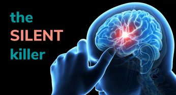 Mengenal Silent Stroke: Si Pembunuh Diam-diam