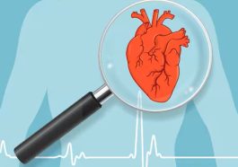 angina refrakter