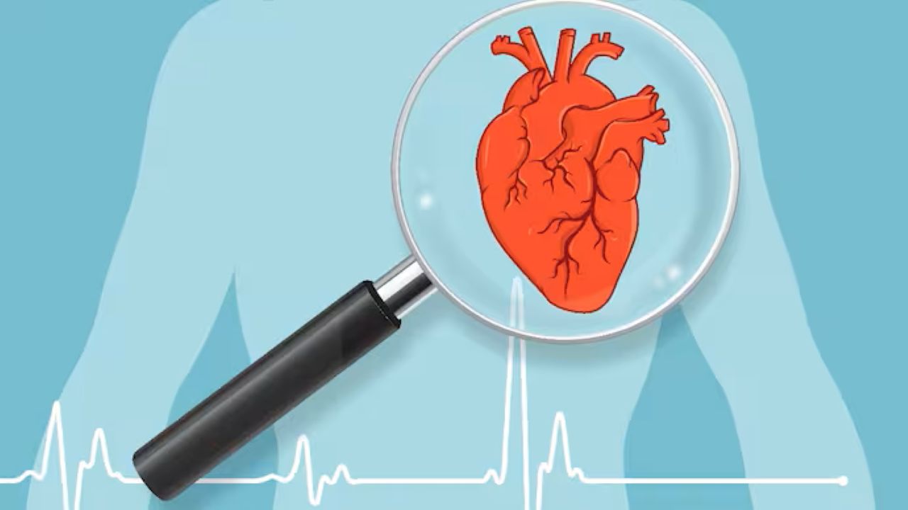 angina refrakter
