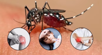 WHO Waspadai Virus Chikungunya, Potensi Jadi Wabah Baru