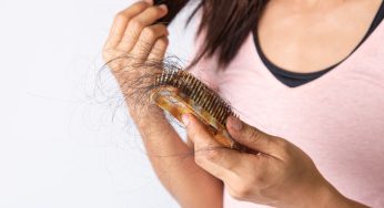 Tanpa Disadari, Ini 5 Penyebab Rambut Cepat Rontok