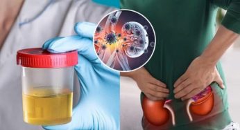 Jangan Abaikan! Kenali Tanda Stres Lewat Perubahan Warna Urine