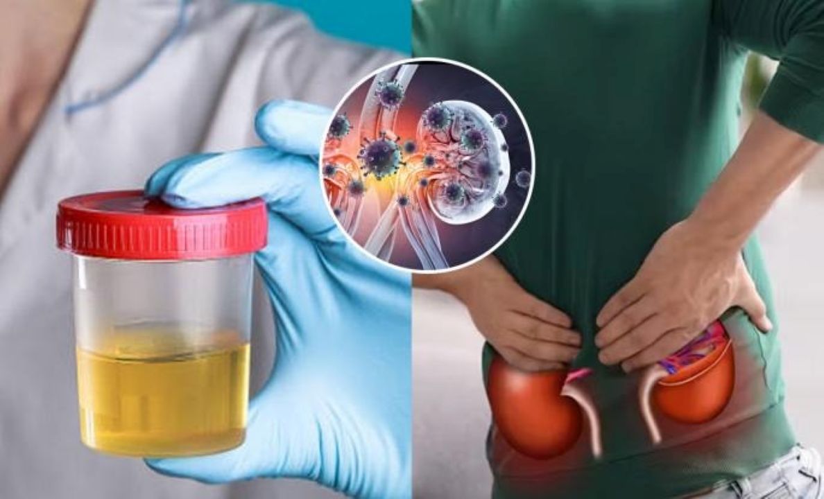 warna urine