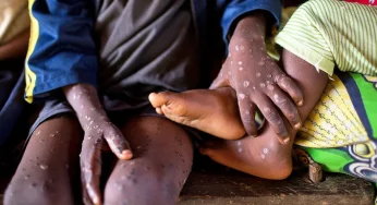WHO Cabut Status Darurat Mpox, Vaksinasi Tetap Jadi Kunci Pertahanan Utama
